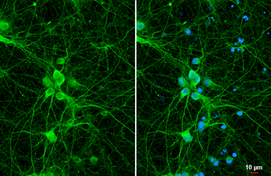 Anti-S100 beta antibody [HL2228] used in Immunocytochemistry/ Immunofluorescence (ICC/IF). GTX638273