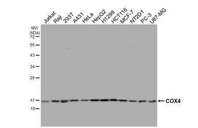 Anti-COX4 antibody [HL2264] used in Western Blot (WB). GTX638316