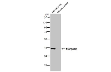 Anti-Stargazin antibody [HL2268] used in Western Blot (WB). GTX638320