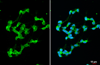 Anti-Stargazin antibody [HL2268] used in Immunocytochemistry/ Immunofluorescence (ICC/IF). GTX638320