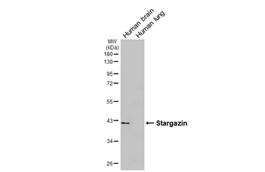 Anti-Stargazin antibody [HL2268] used in Western Blot (WB). GTX638320