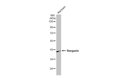 Anti-Stargazin antibody [HL2268] used in Western Blot (WB). GTX638320