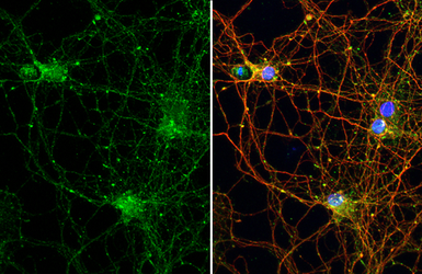 Anti-Stargazin antibody [HL2268] used in Immunocytochemistry/ Immunofluorescence (ICC/IF). GTX638320