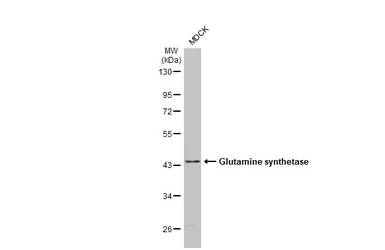 Anti-Glutamine synthetase antibody [HL2283] used in Western Blot (WB). GTX638336