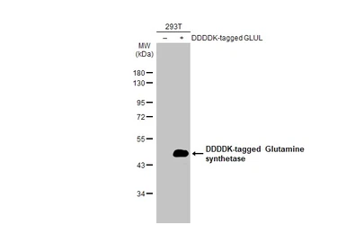 Anti-Glutamine synthetase antibody [HL2283] used in Western Blot (WB). GTX638336