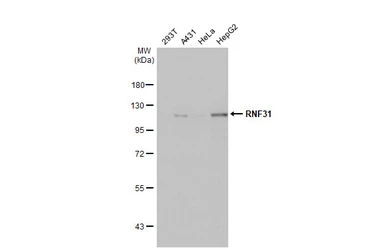 Anti-RNF31 antibody [HL2295] used in Western Blot (WB). GTX638350