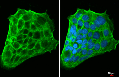 Anti-LAT1 / SLC7A5 antibody [HL2353] used in Immunocytochemistry/ Immunofluorescence (ICC/IF). GTX638556