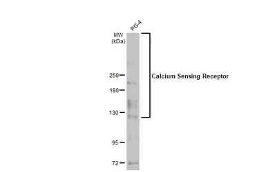 Anti-Calcium Sensing Receptor antibody [HL2357] used in Western Blot (WB). GTX638563