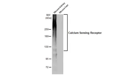 Anti-Calcium Sensing Receptor antibody [HL2357] used in Western Blot (WB). GTX638563