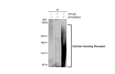 Anti-Calcium Sensing Receptor antibody [HL2357] used in Immunoprecipitation (IP). GTX638563