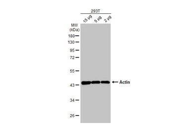 Anti-Actin antibody [HL2372] used in Western Blot (WB). GTX638580