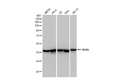 Anti-Actin antibody [HL2372] used in Western Blot (WB). GTX638580