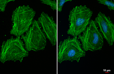 Anti-Actin antibody [HL2372] used in Immunocytochemistry/ Immunofluorescence (ICC/IF). GTX638580