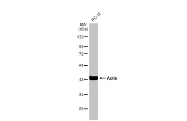 Anti-Actin antibody [HL2372] used in Western Blot (WB). GTX638580