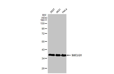 Anti-SUCLG1 antibody [HL2387] used in Western Blot (WB). GTX638596