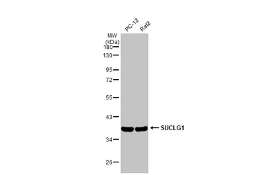 Anti-SUCLG1 antibody [HL2387] used in Western Blot (WB). GTX638596