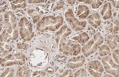 Anti-SUCLG1 antibody [HL2387] used in IHC (Paraffin sections) (IHC-P). GTX638596