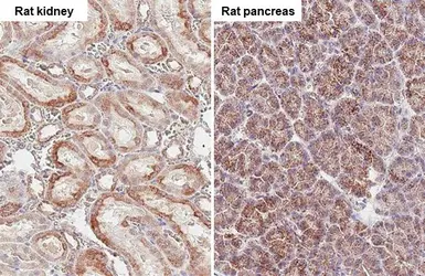 Anti-SUCLG1 antibody [HL2387] used in IHC (Paraffin sections) (IHC-P). GTX638596