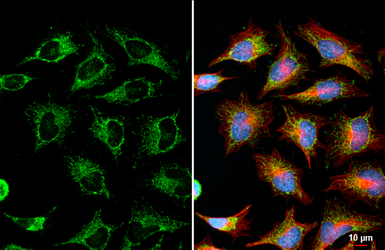 Anti-SUCLG1 antibody [HL2387] used in Immunocytochemistry/ Immunofluorescence (ICC/IF). GTX638596