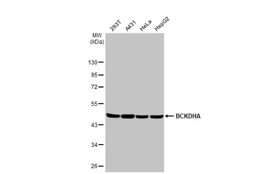 Anti-BCKDHA antibody [HL2405] used in Western Blot (WB). GTX638622