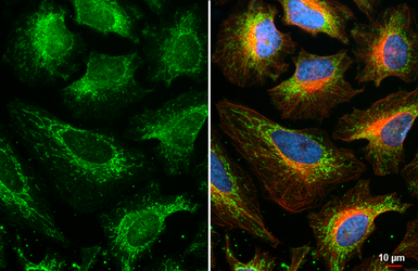 Anti-BCKDHA antibody [HL2405] used in Immunocytochemistry/ Immunofluorescence (ICC/IF). GTX638622