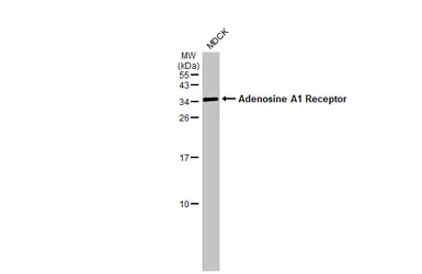 Anti-Adenosine A1 Receptor antibody [HL2442] used in Western Blot (WB). GTX638758