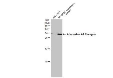 Anti-Adenosine A1 Receptor antibody [HL2442] used in Western Blot (WB). GTX638758