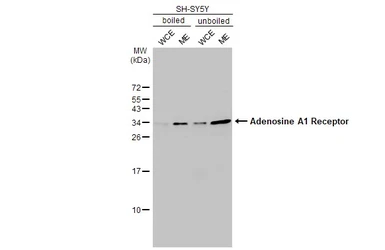 Anti-Adenosine A1 Receptor antibody [HL2442] used in Western Blot (WB). GTX638758