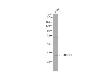 Anti-AGTR1 antibody [HL2524] used in Western Blot (WB). GTX638885