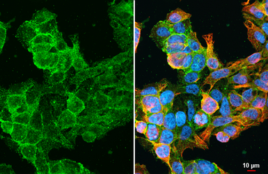 Anti-AGTR1 antibody [HL2524] used in Immunocytochemistry/ Immunofluorescence (ICC/IF). GTX638885