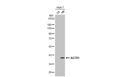 Anti-AGTR1 antibody [HL2524] used in Western Blot (WB). GTX638885