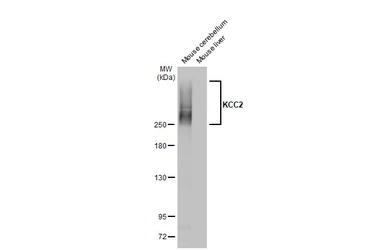 Anti-KCC2 antibody [HL2535] used in Western Blot (WB). GTX638904