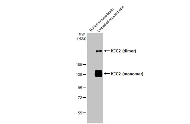 Anti-KCC2 antibody [HL2535] used in Western Blot (WB). GTX638904