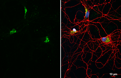 Anti-KCC2 antibody [HL2535] used in Immunocytochemistry/ Immunofluorescence (ICC/IF). GTX638904