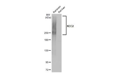 Anti-KCC2 antibody [HL2535] used in Western Blot (WB). GTX638904