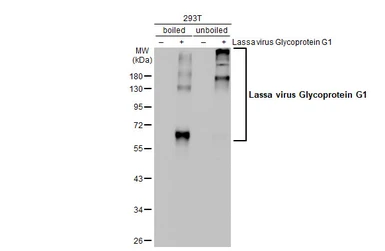 Anti-Lassa virus Glycoprotein G1 antibody [HL2536] used in Western Blot (WB). GTX638905