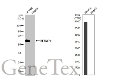 Anti-EFEMP1 antibody [HL2572] used in Western Blot (WB). GTX638950