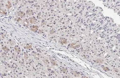 Anti-EFEMP1 antibody [HL2572] used in IHC (Paraffin sections) (IHC-P). GTX638950