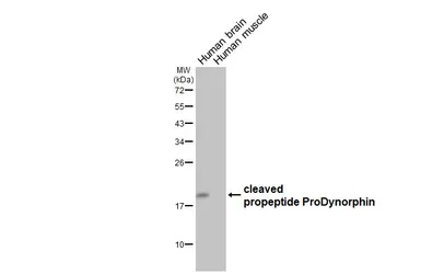 Anti-ProDynorphin antibody [HL2573] used in Western Blot (WB). GTX638951