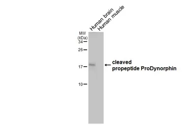 Anti-ProDynorphin antibody [HL2574] used in Western Blot (WB). GTX638952