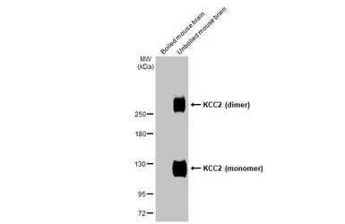 Anti-KCC2 antibody [HL2624] used in Western Blot (WB). GTX639080