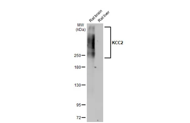 Anti-KCC2 antibody [HL2624] used in Western Blot (WB). GTX639080