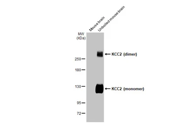 Anti-KCC2 antibody [HL2625] used in Western Blot (WB). GTX639081