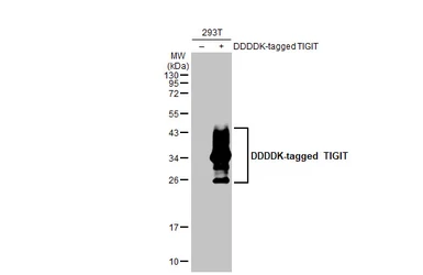 Anti-TIGIT antibody [HL2657] used in Western Blot (WB). GTX639116