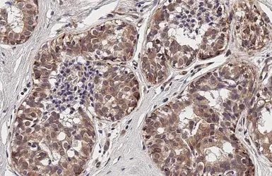 Anti-TIGIT antibody [HL2657] used in IHC (Paraffin sections) (IHC-P). GTX639116