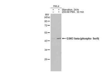 Anti-GSK3 beta (phospho Ser9) antibody [HL2671] used in Western Blot (WB). GTX639335