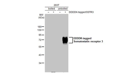 Anti-Somatostatin receptor 3 antibody [HL2681] used in Western Blot (WB). GTX639345