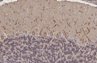 Anti-Somatostatin receptor 3 antibody [HL2681] used in IHC (Paraffin sections) (IHC-P). GTX639345