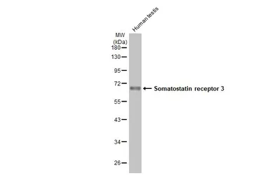 Anti-Somatostatin receptor 3 antibody [HL2681] used in Western Blot (WB). GTX639345