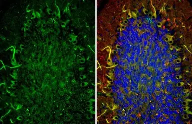 Anti-Somatostatin receptor 3 antibody [HL2681] used in IHC (Paraffin sections) (IHC-P). GTX639345